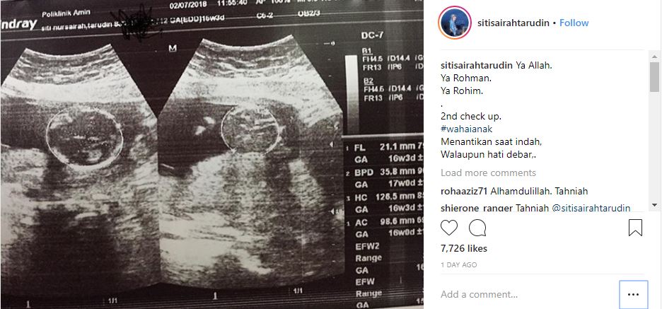 Instagram @sitisairahtarudin Sairah berkongsi foto imbasan ultrasound.